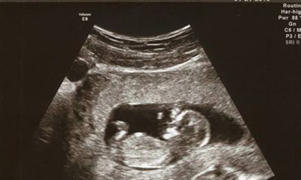 How to Make Your Fake Ultrasound Prank More Convincing